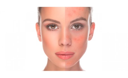 Όσα πρέπει να ξέρουμε για την ακμή των... μεγάλων