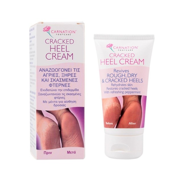 VICAN CARNATION CRACKED HEEL CREAM 50ml